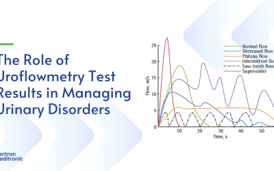The Role of Uroflowmetry Test Results in Managing Urinary Disorders